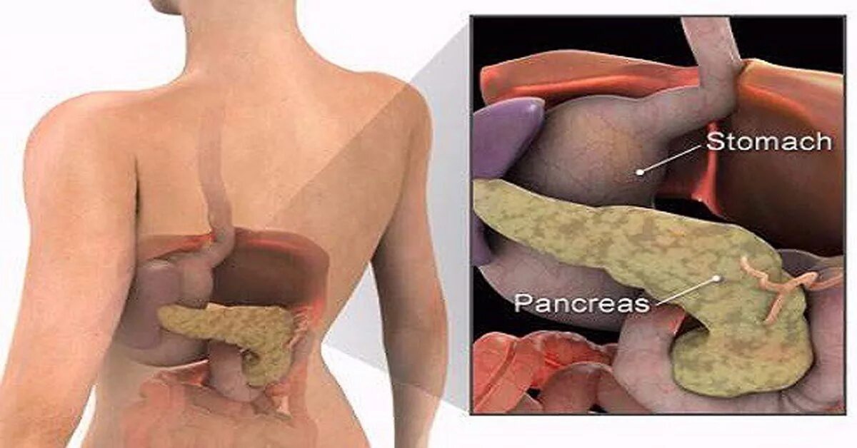 Поджелудочная железа расположение. Расположение поджелудочной железы у человека. Расположение желудка и поджелудочной. Желчный пузырь и поджелудочная железа расположение. Боли в желудке от железа
