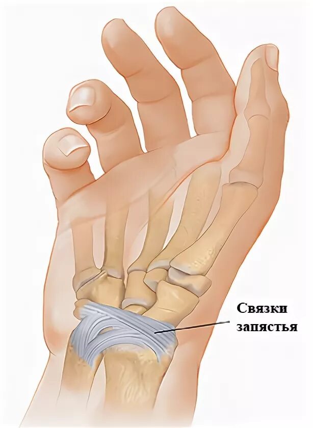 Связки на руке. Растяжение связок лучезапястного сустава. Разрыв связок лучезапястного сустава. Повреждение капсульно-связочного аппарата кисти. Растяжение сухожилий кисти руки.