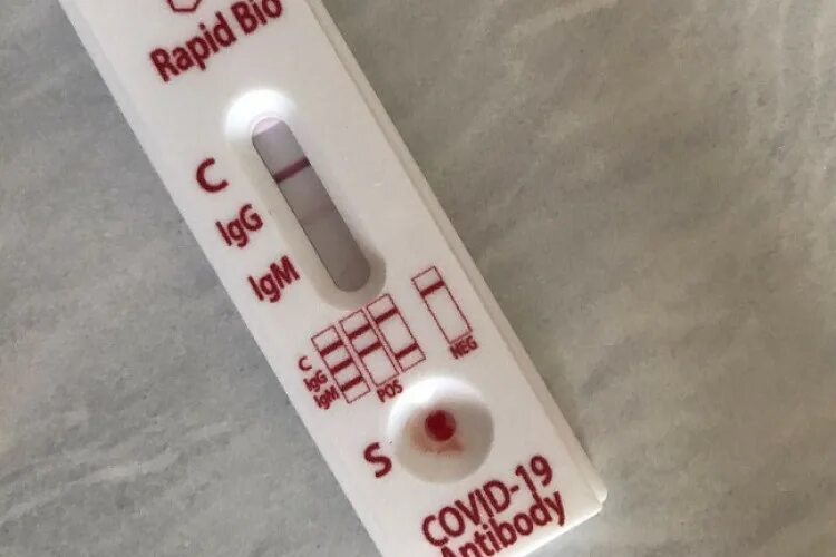 Положительный экспресс тест. Положительный экспресс тест на коронавирус. Положительный эксперстест на коронавирус. Отрицательный экспресс тест на коронавирус. Сдача теста ковид