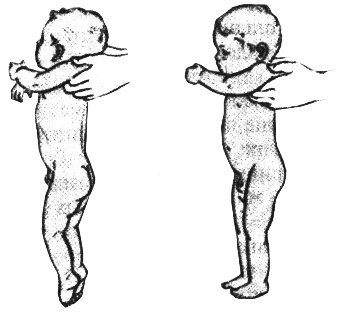 Врожденные рефлексы новорожденных. Рефлекс опоры новорожденного. Рефлекс опоры и автоматическая походка новорождённых. Рефлекс опоры у грудничка.