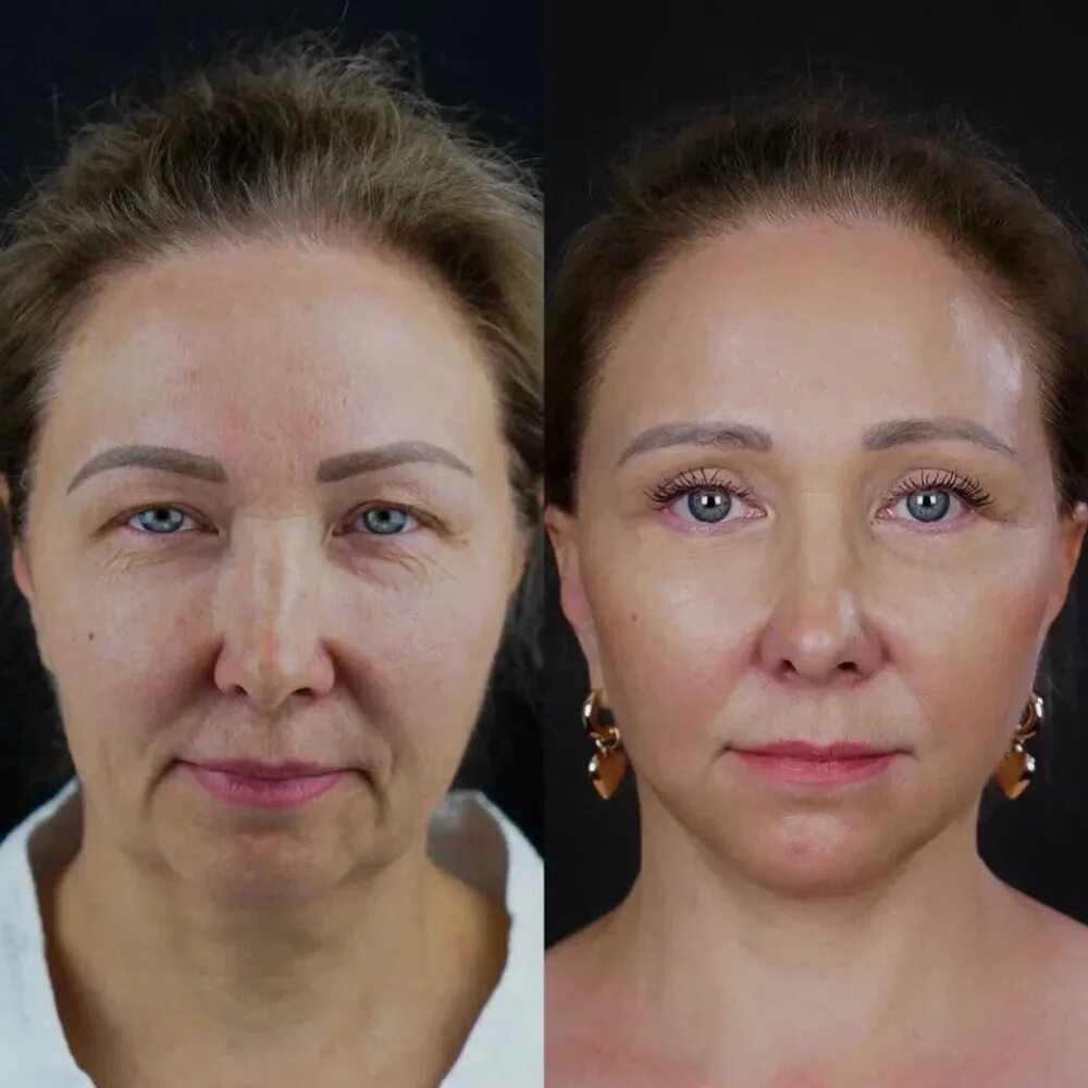 тумаков отзывы