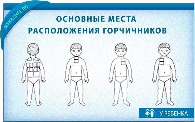 Горчичники ребенку при кашле 2,5 года. Горчичники при кашле детям. Как ставить горчичники при кашле детям. Куда ставить горчичники р.