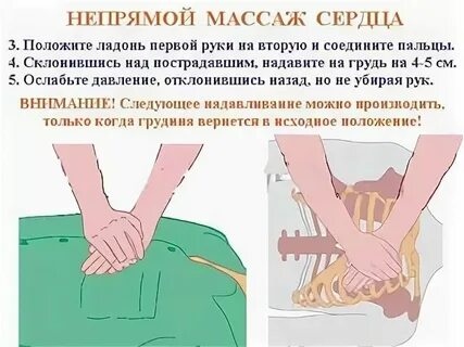 Темп непрямого массажа сердца в минуту