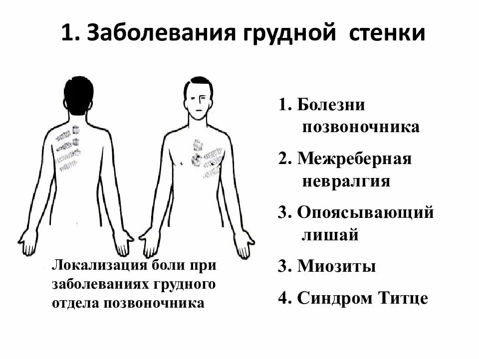 Болят груди ноющая боль