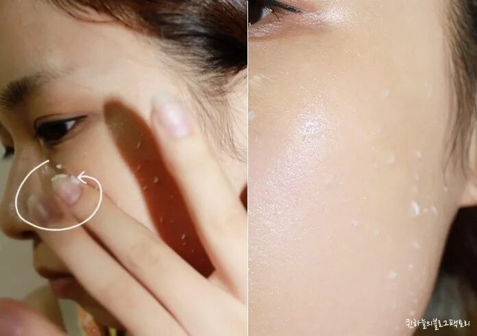 Пилинг сколько раз в неделю. Химические пилинги для лица. Пилинги химические для лица показания. Салициловая и молочная кислота пилинг. Узи чистка лица.