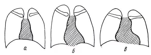 Варианты формы и положения. Типы положения сердца. Основные формы положения и положения желудка. Формк черепа. Расположение и форма желудка.
