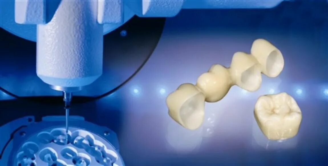 Cad cam это. Cad cam системы в стоматологии. кад кам технологии в стоматологии. диоксид циркония cad cam технология. фрезерование коронок cad cam.