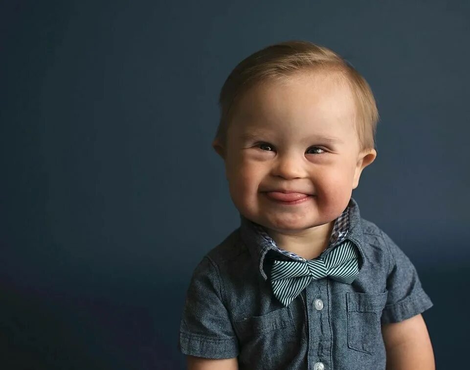 Как выглядит ребенок с синдромом. Как выглядит ребенок с синдромом. Ребенок даун. Дети с синдромом дауна. Дети с синдромом даунизма.