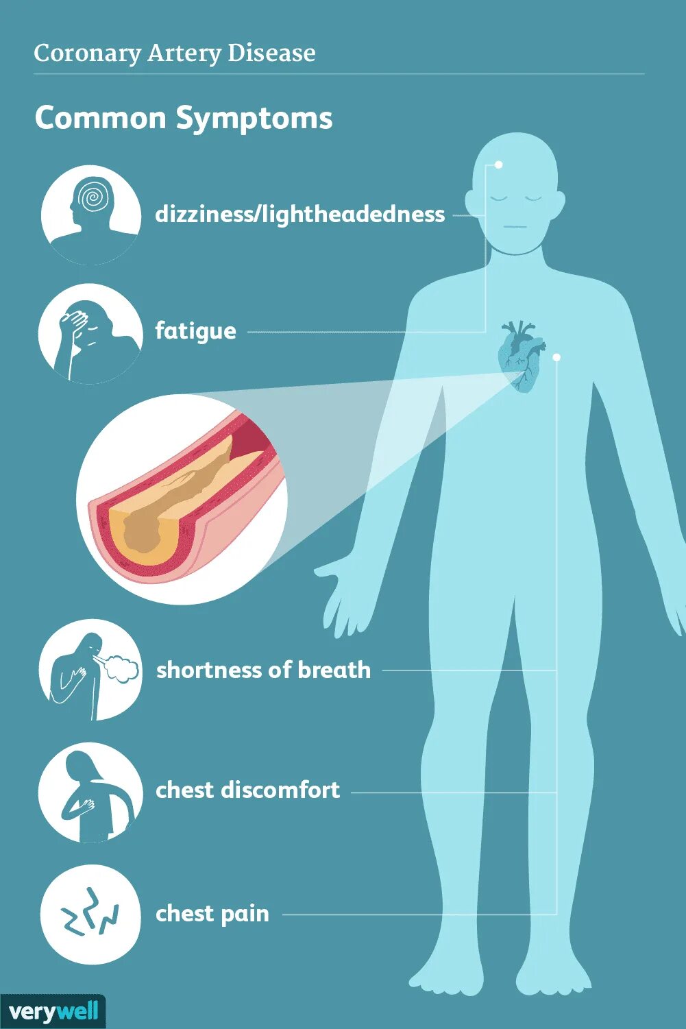 Disease symptoms. Disease symptoms. Disease symptoms. Heart failure. Хобл картинки для презентации.