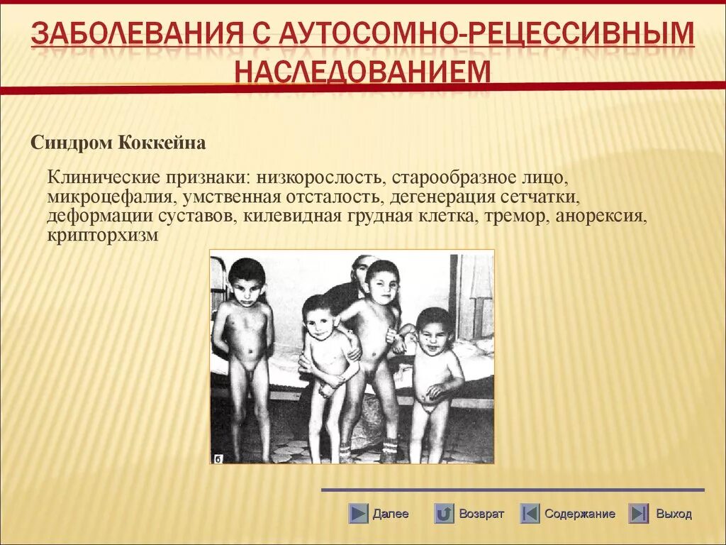 Наследственной умственной отсталости. Синдром Нунан Тип наследования. Генные аутосомно рецессивные заболевания. Аутосомно рецессивное наследование заболевания. Аутосомно-рецессивные генные болезни человека.