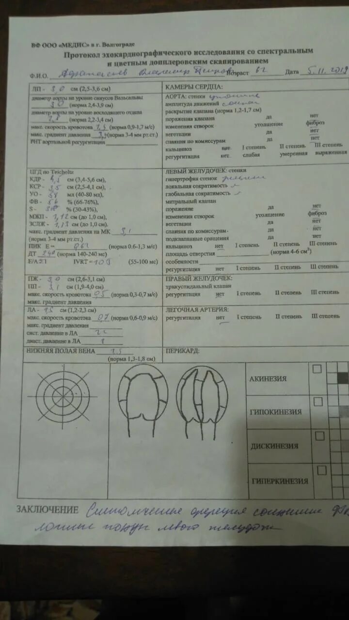 Узи сердца при сердечной недостаточности - Вопрос кардиологу - 03 Онлайн