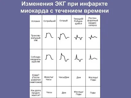 Изменения на экг при инфаркте миокарда