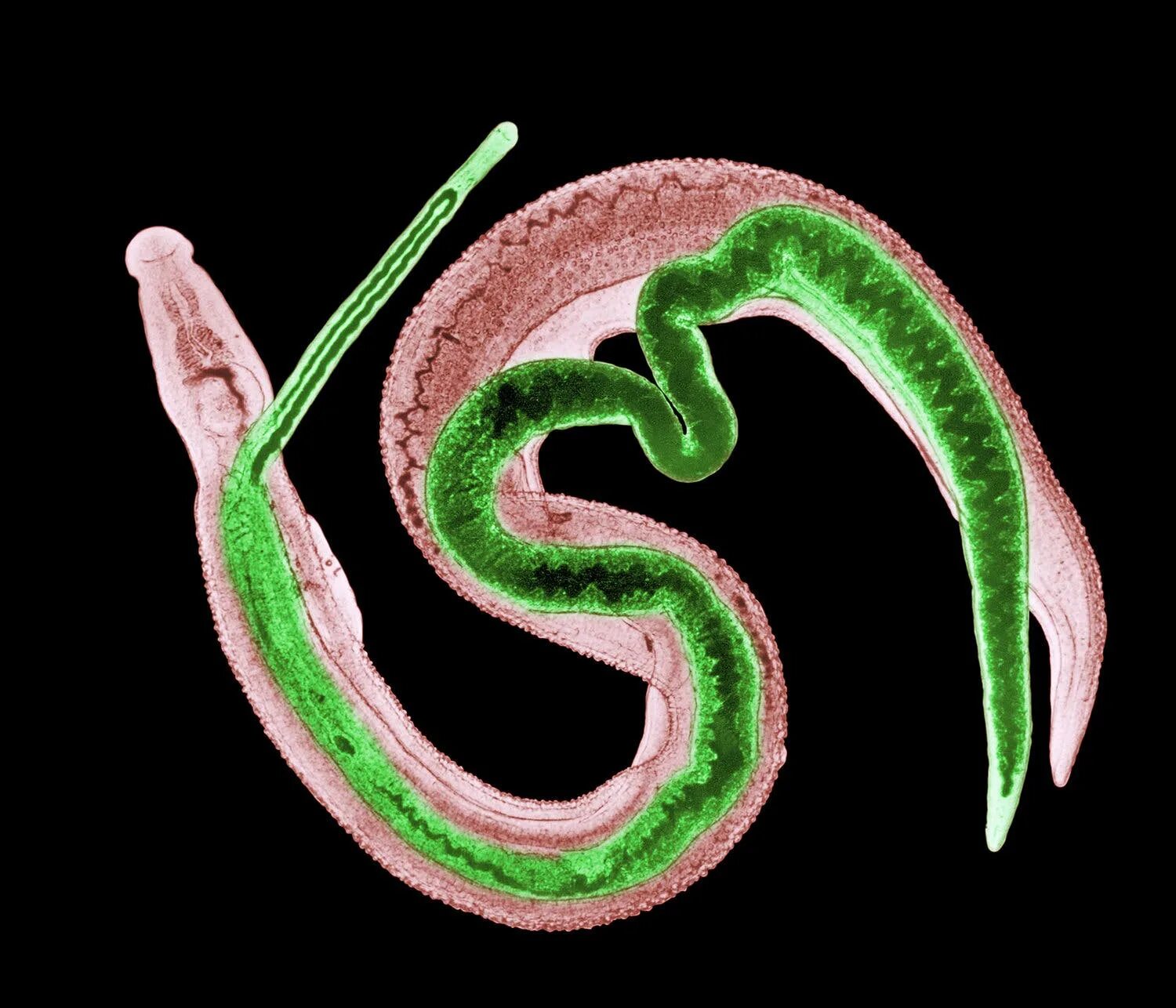 Шистосома Мансони. Schistosomiasis паразит. Глистные инвазии трихинеллез. Круглые черви заболевания