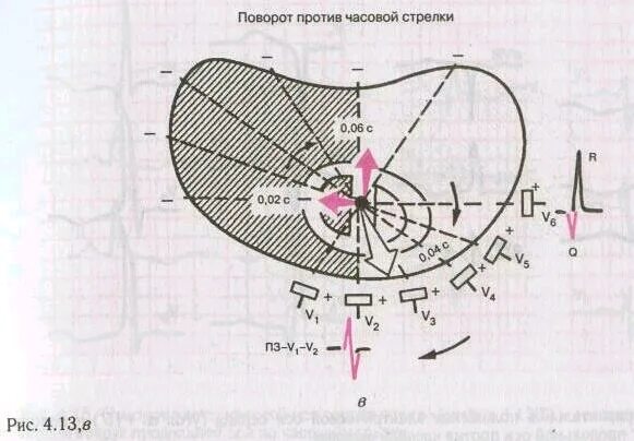 Повороты сердца на ЭКГ вокруг продольной оси. Повороты сердца вокруг оси на ЭКГ. Поворот сердца вокруг продольной оси против часовой стрелки на ЭКГ. Повороту оси сердца на электрокардиограмме. Сердце против часовой стрелки