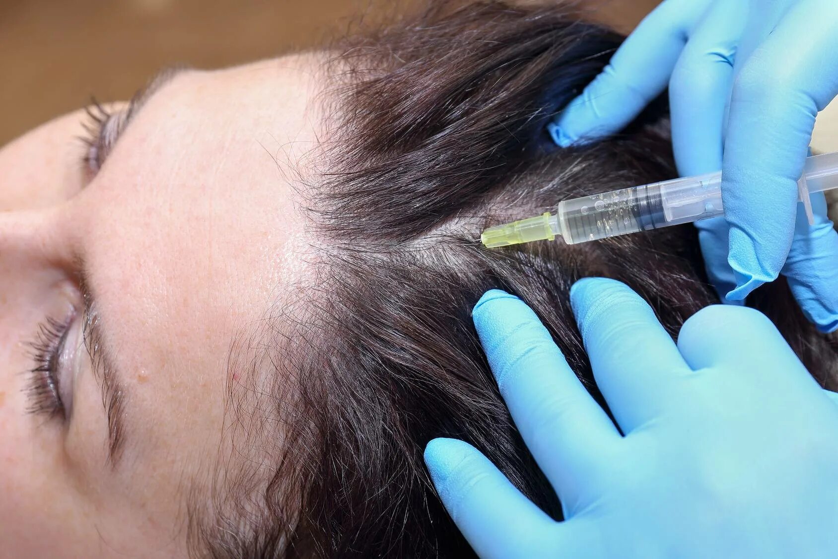 Hair treatment мезотерапия. PRP Plasma. Мезотерапия для волос. Мезотерапия волосистой части головы. Мезотерапия уколов