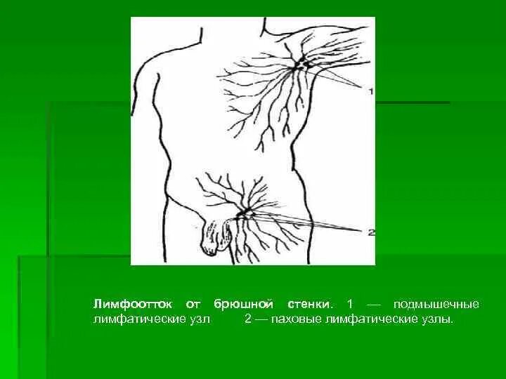 Паховый лимфоузел у женщин где. Лимфоотток передней брюшной стенки. Лимфоузлы брюшной стенки. Переднебоковой брюшной стенки лимфоотток. Лимфатический узел человека.