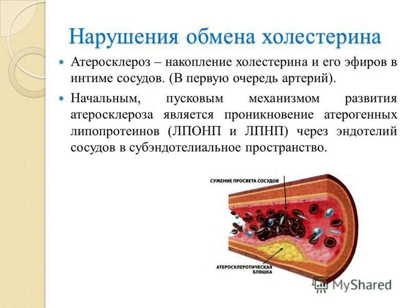 Холестерин синдром