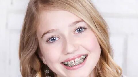#Dentist, #Children, #Health, #Teeth 