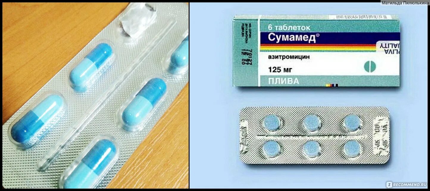 Антибиотик Сумамед 3 таблетки. Антибиотик Sumamed 3 таблетки. Antibiotic Sumamed антибиотик 3 таблетки. Антибиотик от кашля Сумам. Пьют ли антибиотики при кашле без температуры