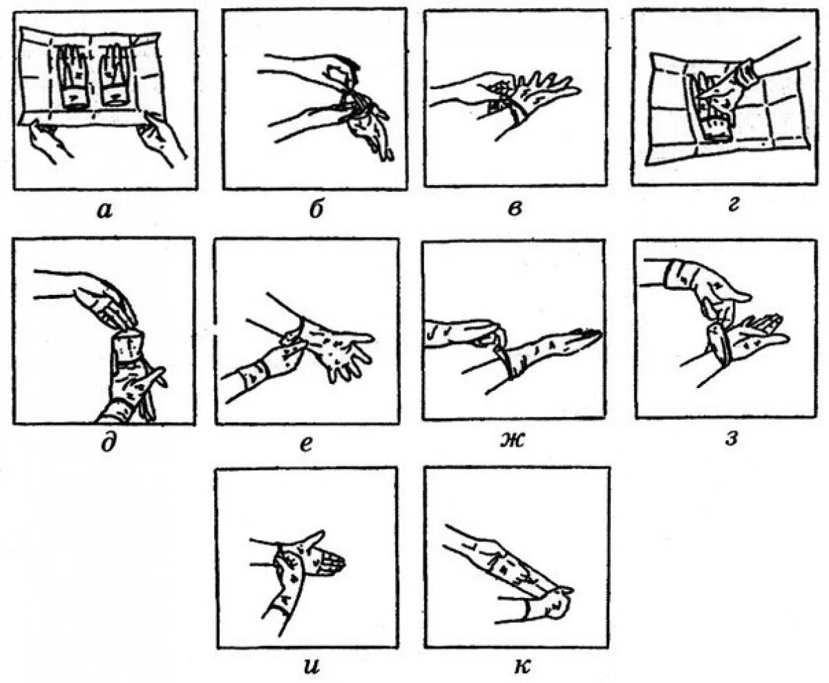 Схема надевания стерильных перчаток. Одевание стерильных перчаток алгоритм. Алгоритм снимания стерильных перчаток. Техника одевания стерильных перчаток. Надевать стерильные перчатки в случаях