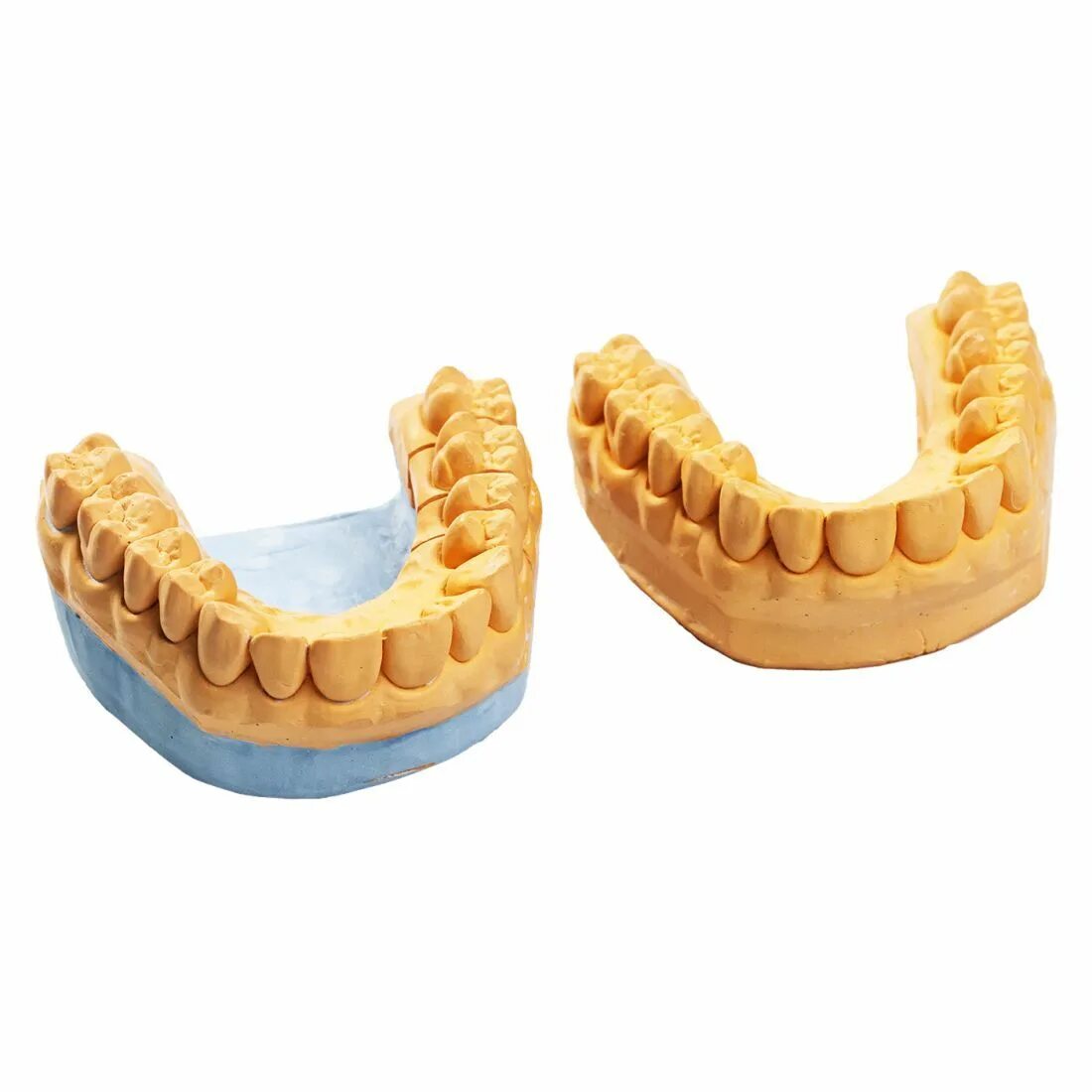 изготовление гипсовой модели. гипсовая модель зубов. гипсовые модели в стоматологии. изготовление гипсовой модели. гипсовые модели челюстей.