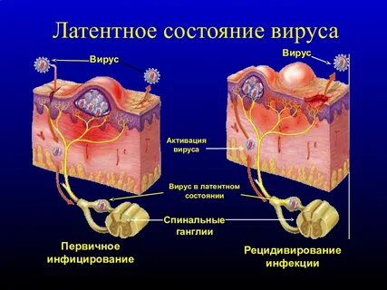 Латентная инфекция