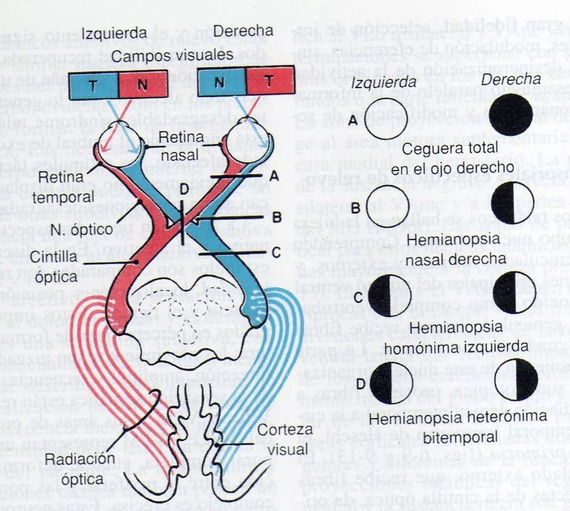 гетеронимная биназальная гемианопсия возникает при поражении. гетеронимная битемпоральная гемианопсия причины. левосторонняя квадрантная гемианопсия. биназальная гемианопсия возникает при поражении. гемианопсия это в неврологии.