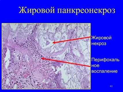 Жир поджелудочная железа