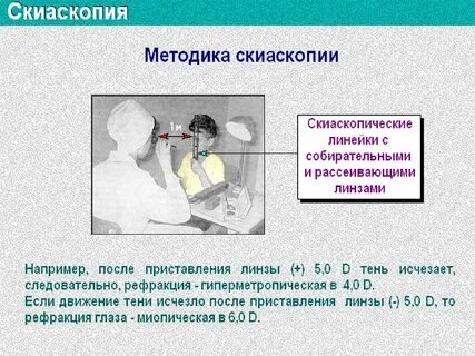 Скиаскопия это