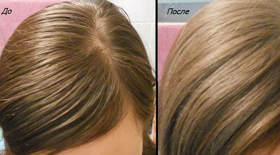 Сухой шампунь для волос до и после. Грязные сальные волосы. Как понять что голова грязная. Чистые волосы и грязные волосы. Грязные волосы.