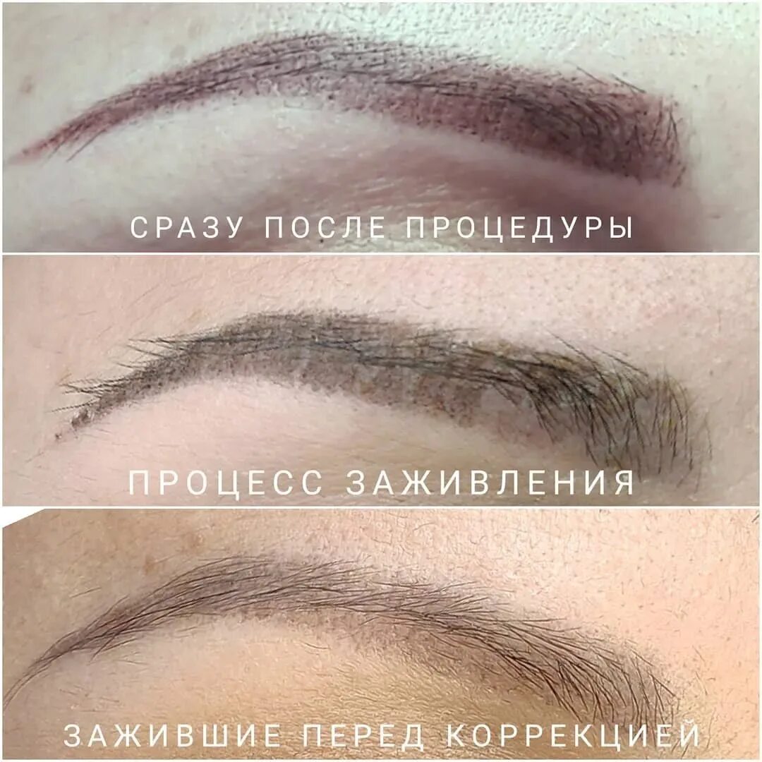 Заживление после пм