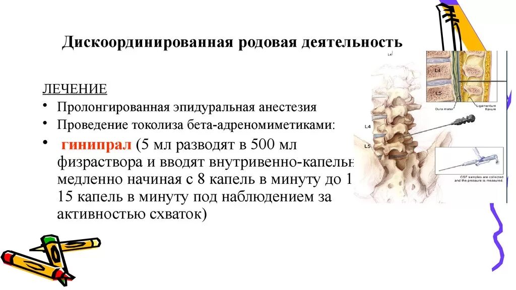 Дискоординированная родовая. Дискоординированная родовая. Степени дискоординации родовой деятельности. Диагностика дискоординации родовой деятельности. Причины дискоординированной родовой деятельности.