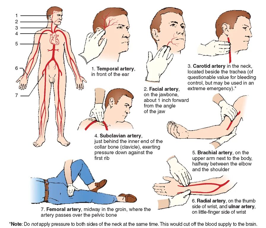 Practice points. Первая помощь на английском. pressure points.