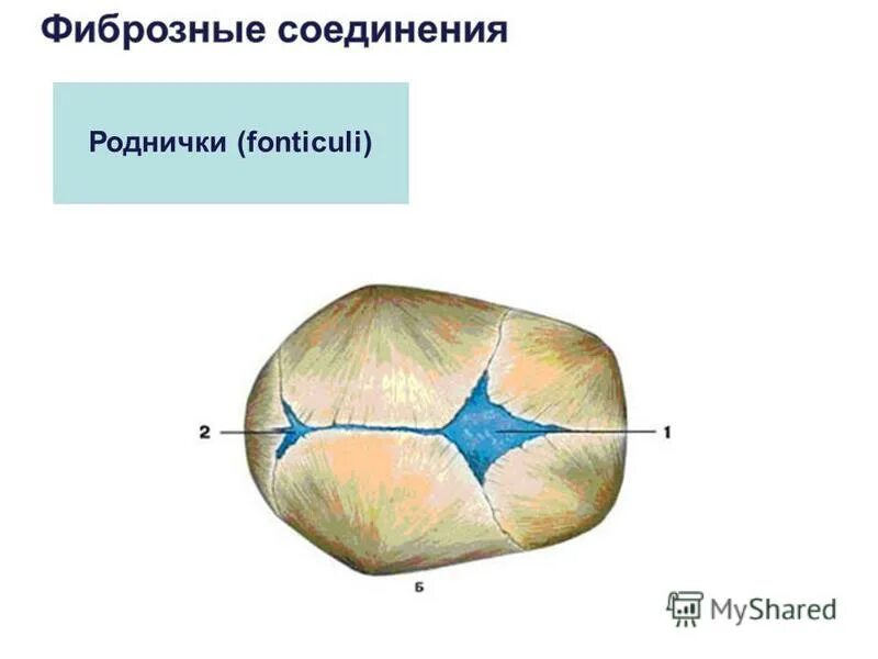 Сколько родничков. Роднички. Границы большого родничка. Большой и малый Родничок. Роднички схема.