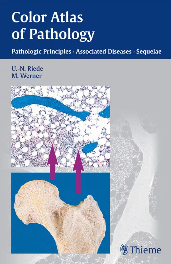 Thieme Color Atlas. Атлас по патологии. Pediatric Pathology книга. Diseases associated