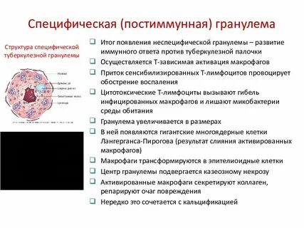 Гранулема туберкулеза