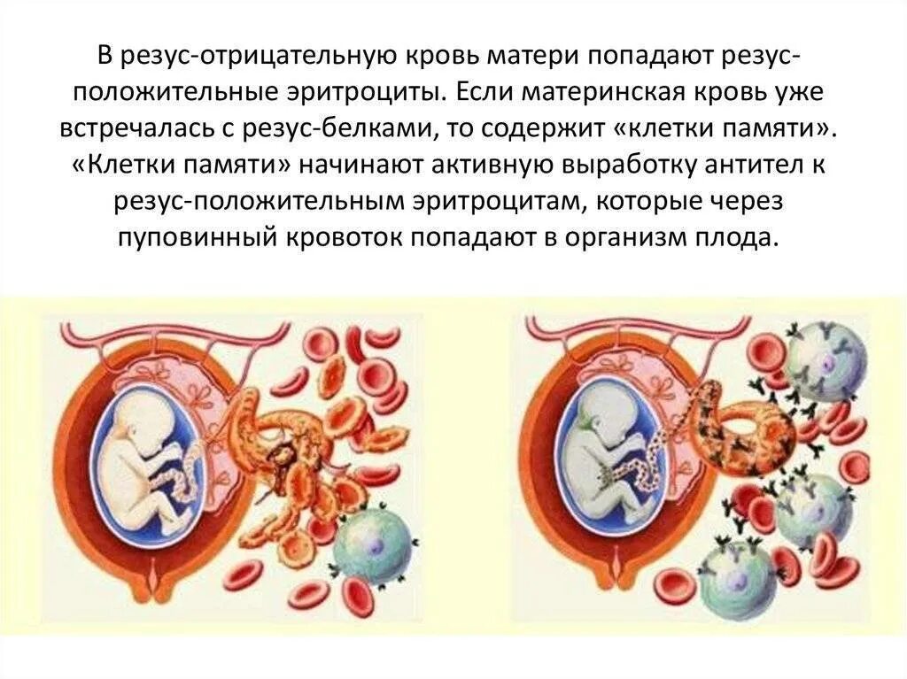 Резус несовместимость крови. Резус-фактор крови отрицательный. Резузотрицательнаякровь. Резус отрицательная кровь. Отрицательный и положительный резус крови.