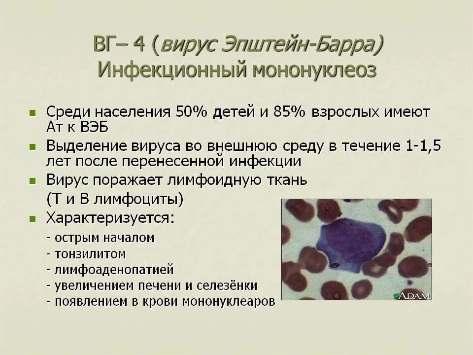 Эпштейн барр в слюне. Вэб вирус Эпштейна Барр. Мононуклеоз Эпштейна-Барр. Инфекции Эпштейн Барра у детей симптомы.