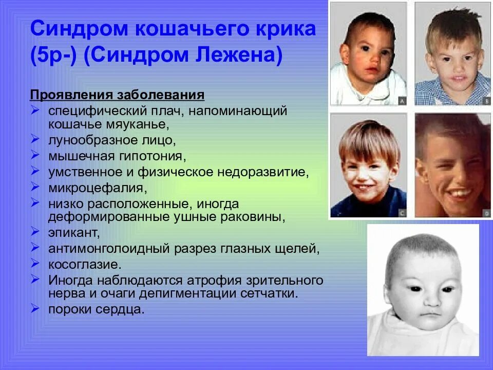 Кошачья болезнь у детей