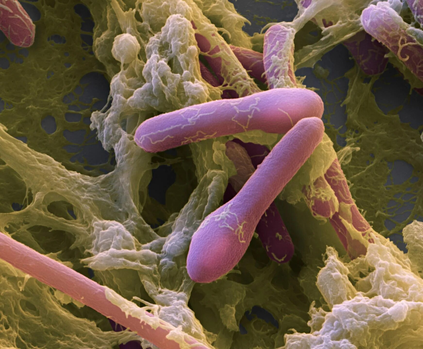 Clostridium spp. Клостридия ботулинум. Клостридии botulinum ботулизм. Бактерии клостридиум ботулинум. Клостридия ботулизма бактерия.