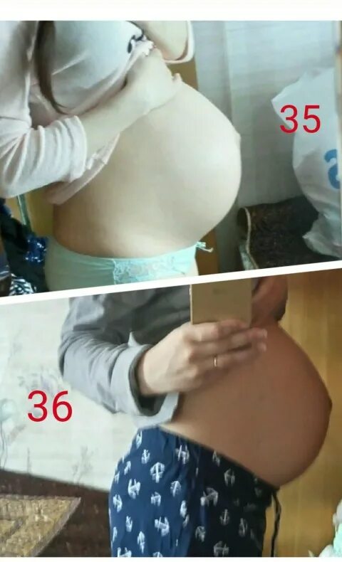 Если живот опустился через сколько ждать роды. Опущенный живот и нет. живот опускается перед родами у первородящих. предвестники родов опущение живота. опущения живота начинаются.