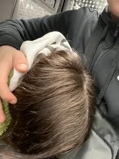Димедролова