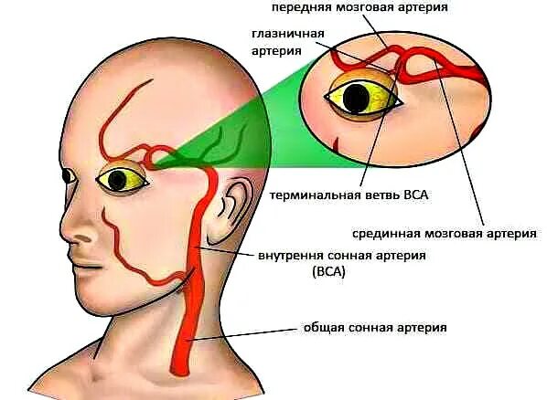 Почему болят глаза при движении температуре. Глазная мигрень. офтальмологическая мигрень. глаза при мигрени. глазная мигрень симптомы.