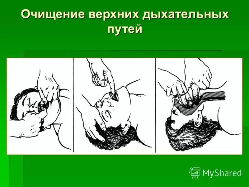 Носоглотка дыхательные пути. Рта и верхних дыхательных путей. Строение дыхательных путей человека анатомия. Рта и верхних дыхательных путей. Верхние дыхательные пути.