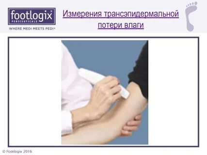 Потеря влаги кожей