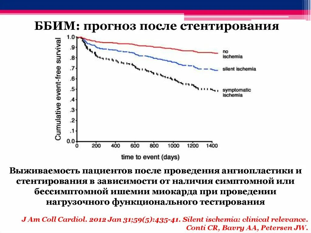 Льготы после инфаркта и стентирования. Безболевая ишемия миокарда. Сколько живут после стентирования?. Продолжительность жизни после стентирования. Стентирование прогнозы