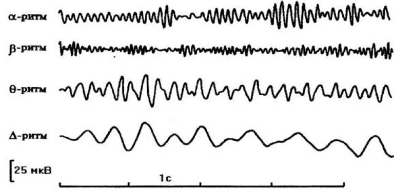 Частота ээг. Альфа и бета ритмы на ЭЭГ. Ритмы мозга Альфа бета тета Дельта ритмы. Тета ритм ЭЭГ. Биоэлектрическая активность головного мозга. Ритмы ЭЭГ..