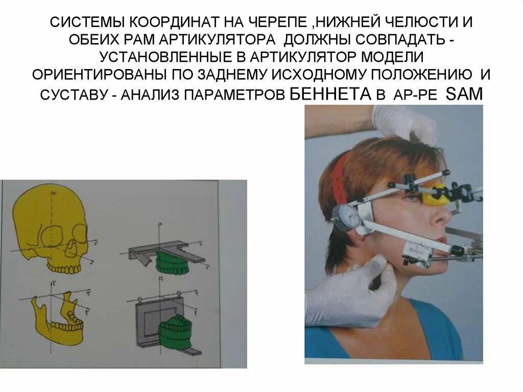 Артикуляция аппараты. Аппараты воспроизводящие движения нижней челюсти. Артикуляция нижней челюсти. Артикуляция и окклюзия. Аппарат для движения челюсти.