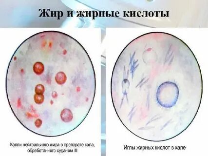 Жир в кале