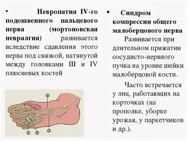 Невропатия малоберцового нерва. Невропатия большеберцового и малоберцового нервов. Невропатия подошвенных нервов. Передний тарзальный синдром. Посттравматическая нейропатия мкб